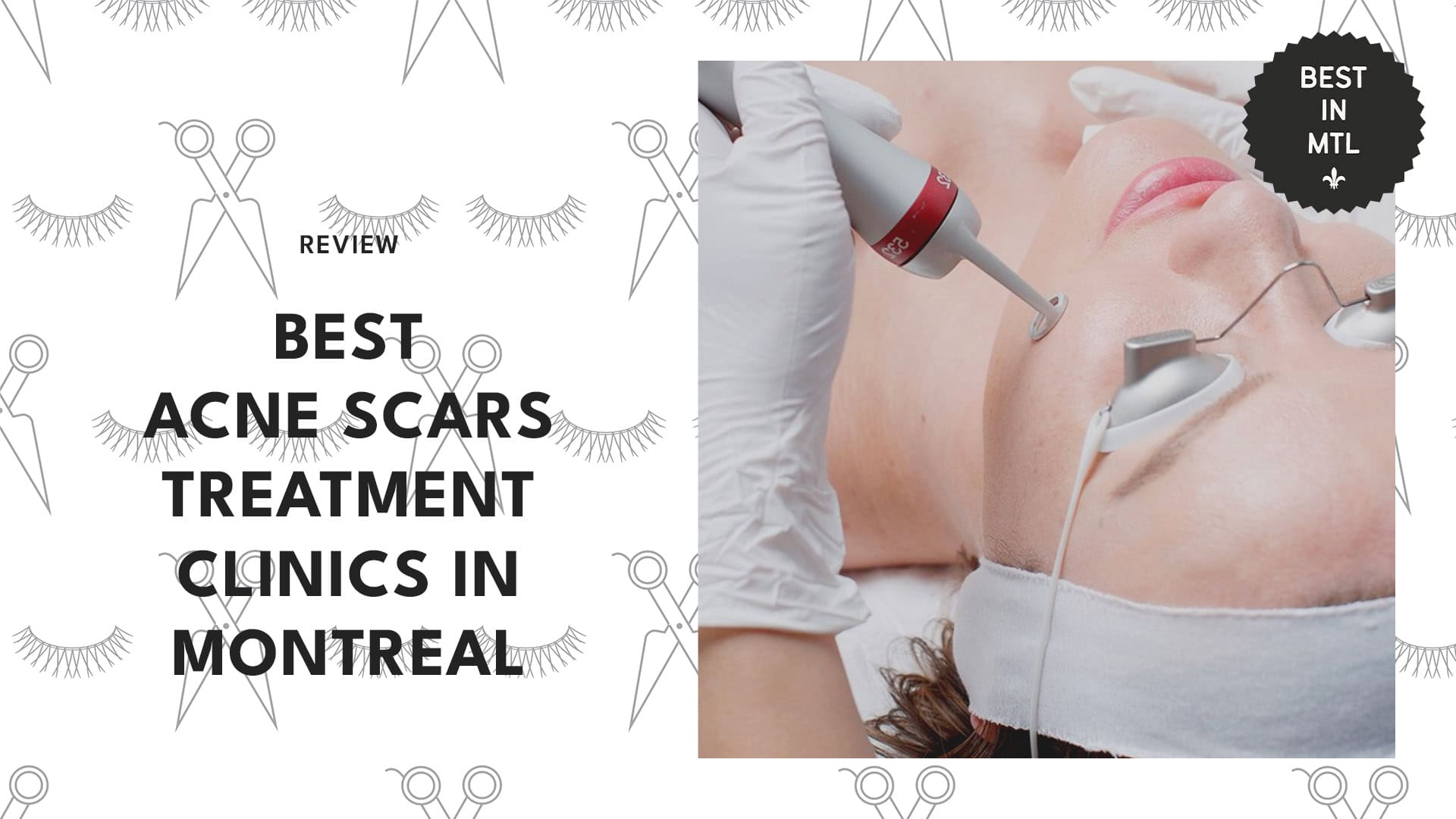 acne-scar-treatments