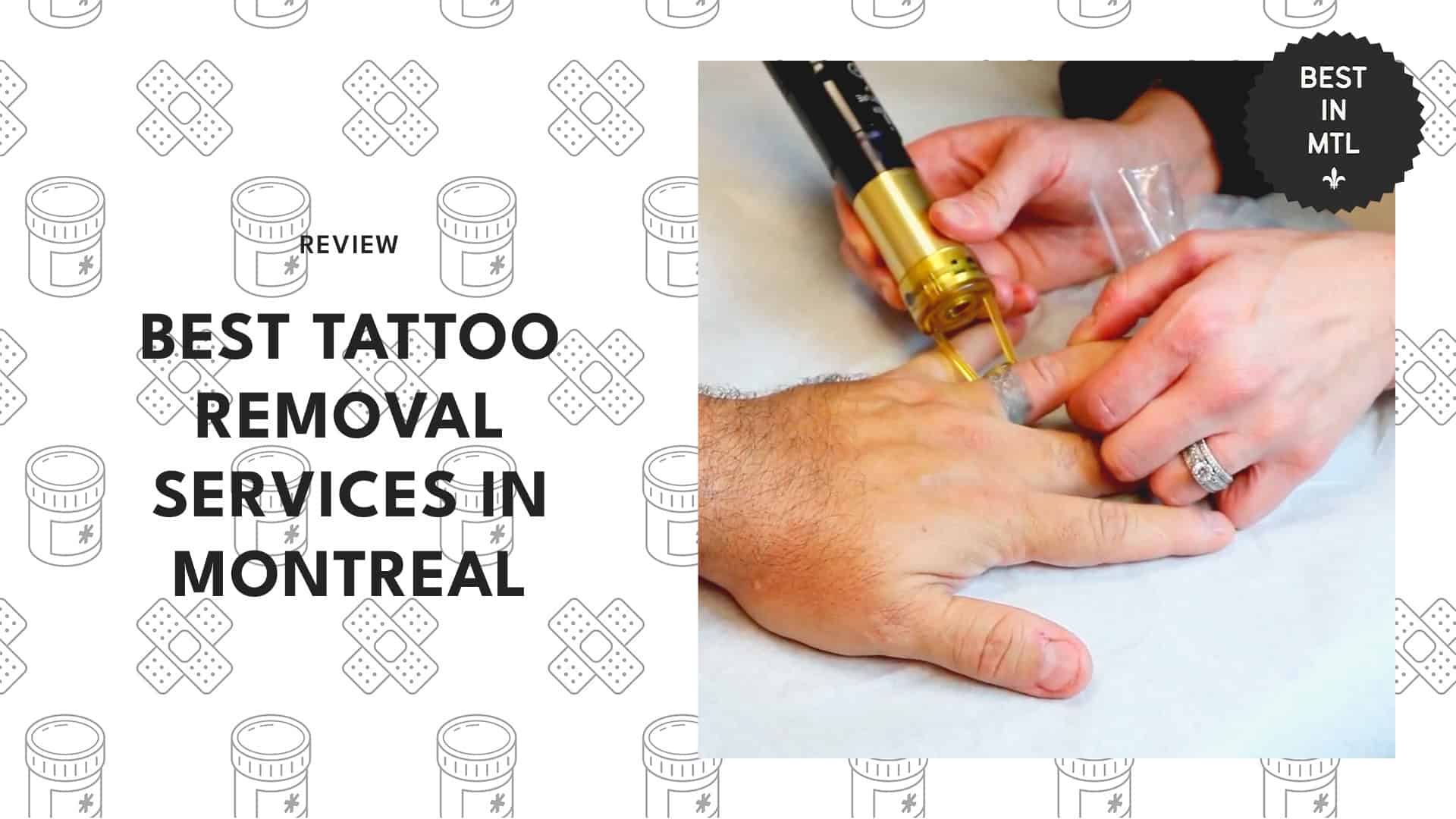 tattoo-removal-services-montreal