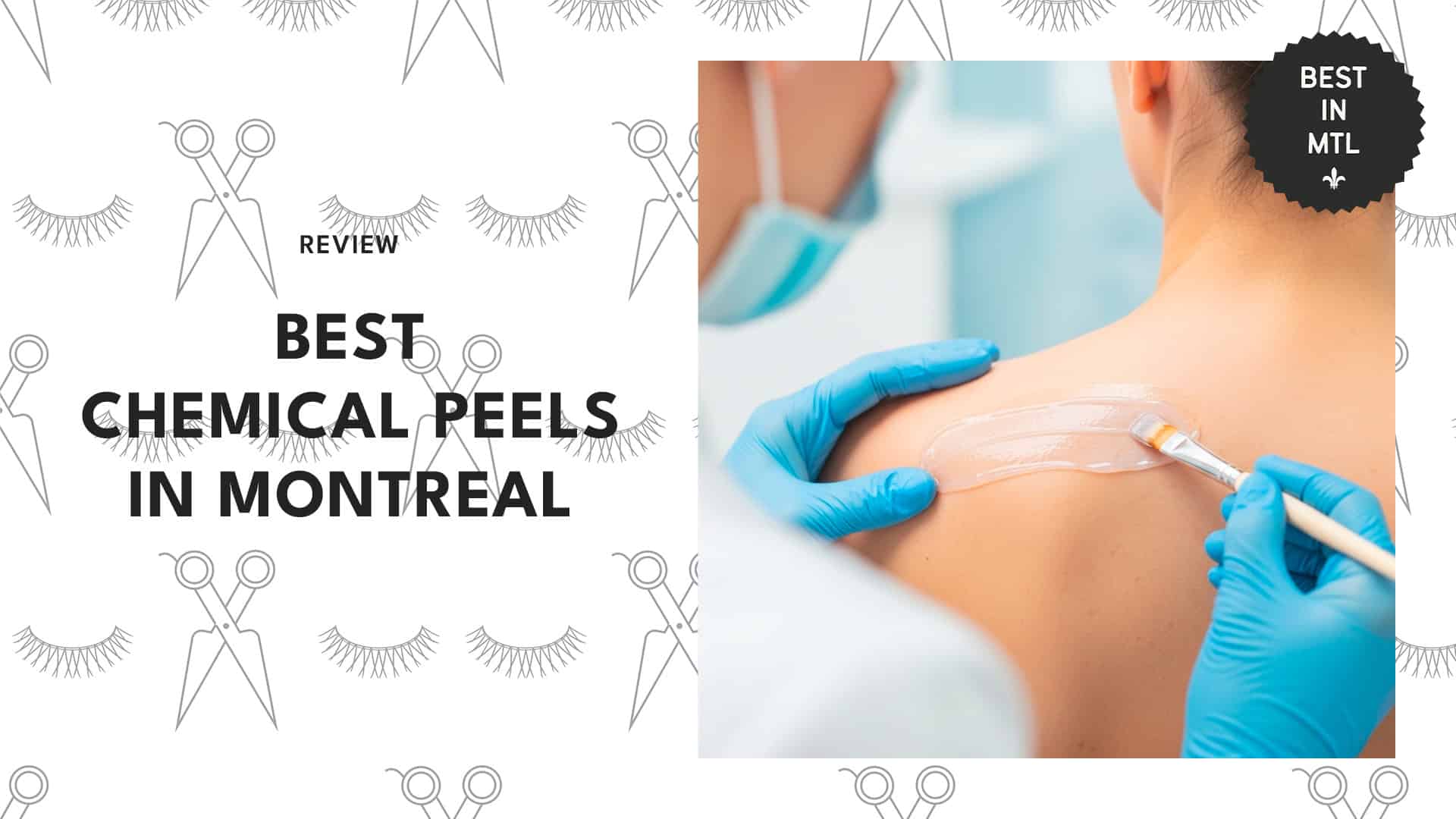 chemical-peel-montreal