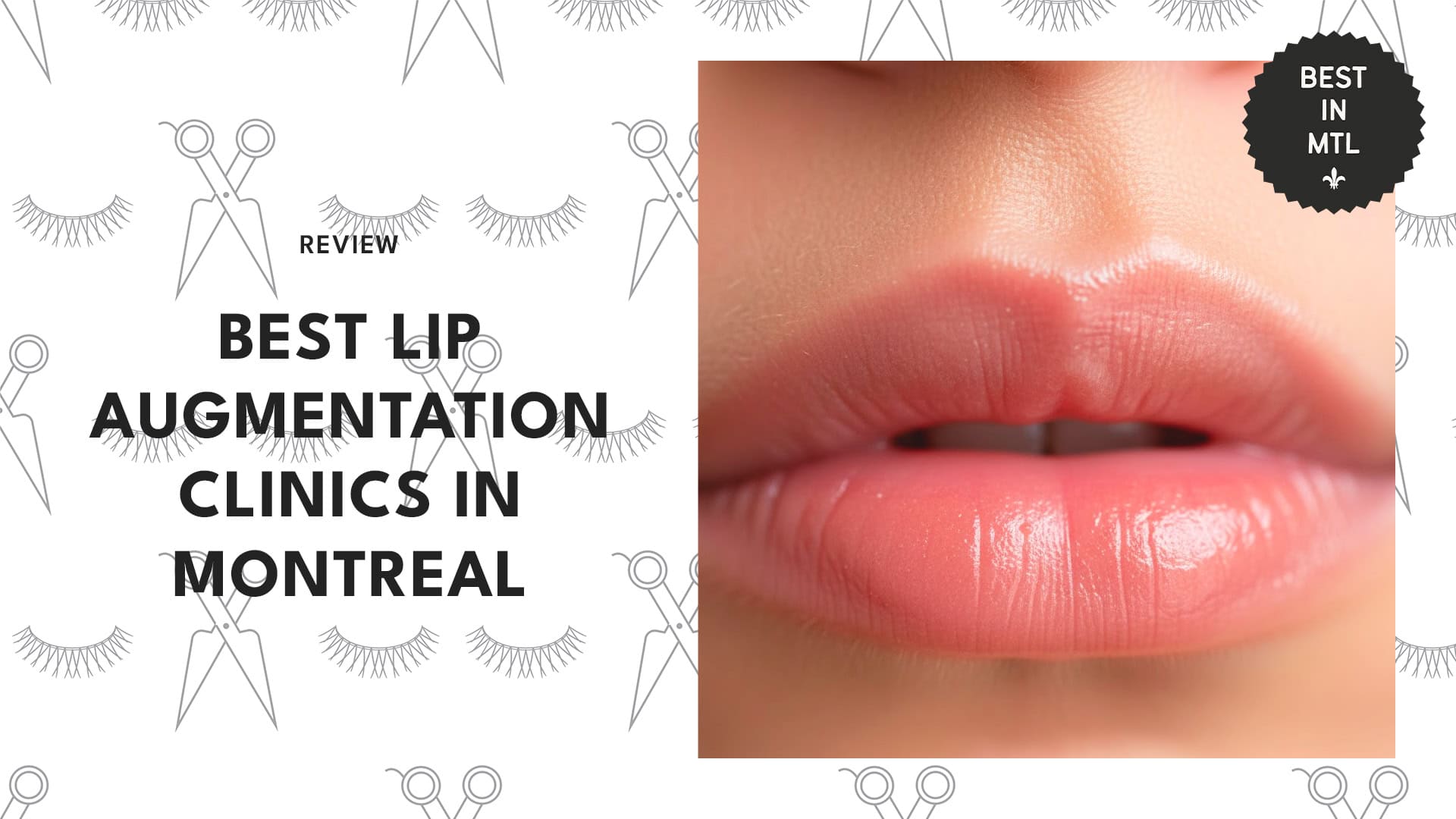 lip-augmentation-montreal